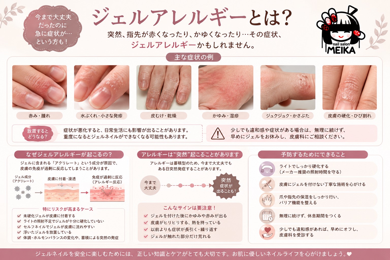 ジェルアレルギーとは？症状・原因・予防