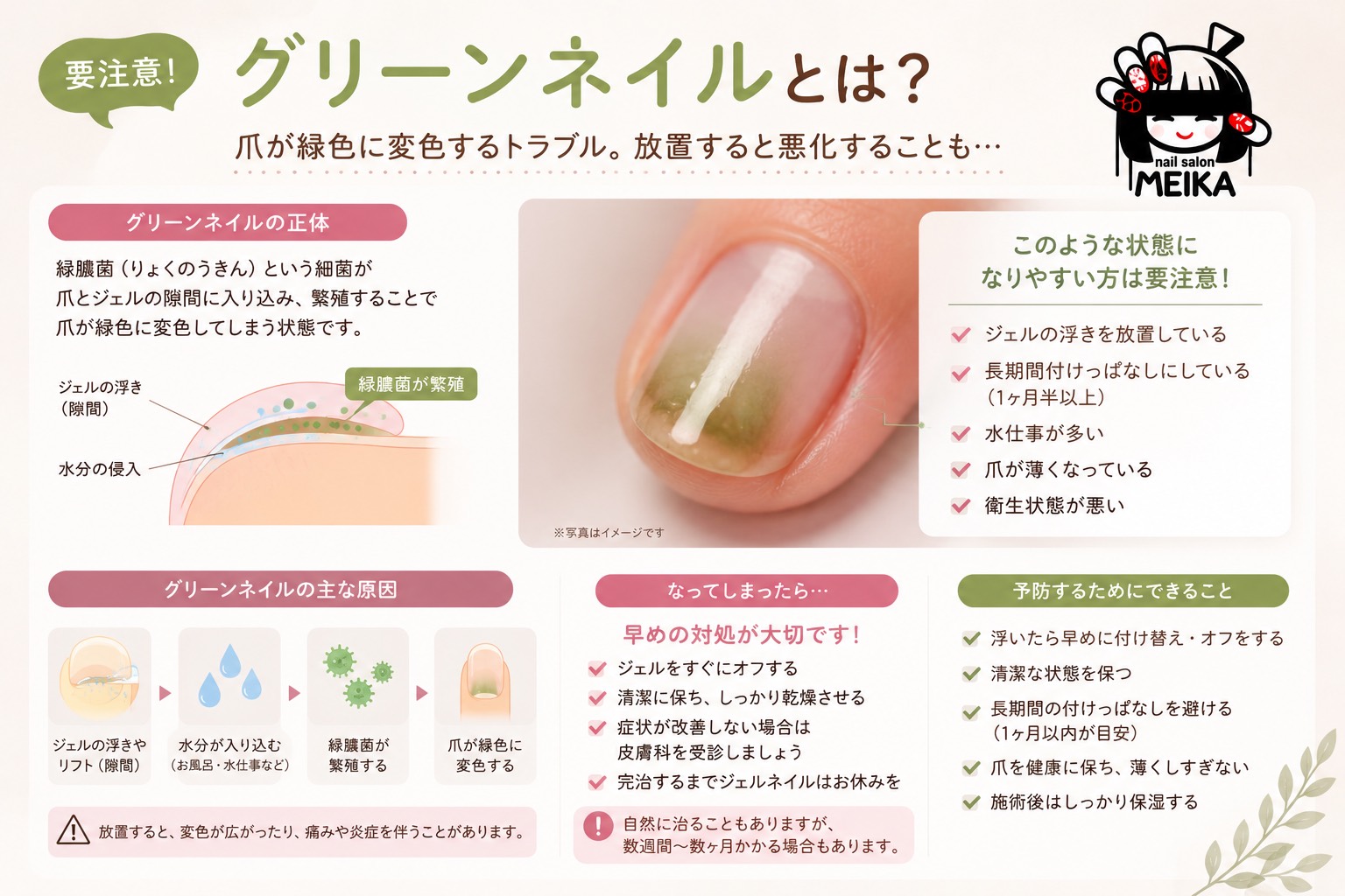 グリーンネイルとは？原因・対処・予防